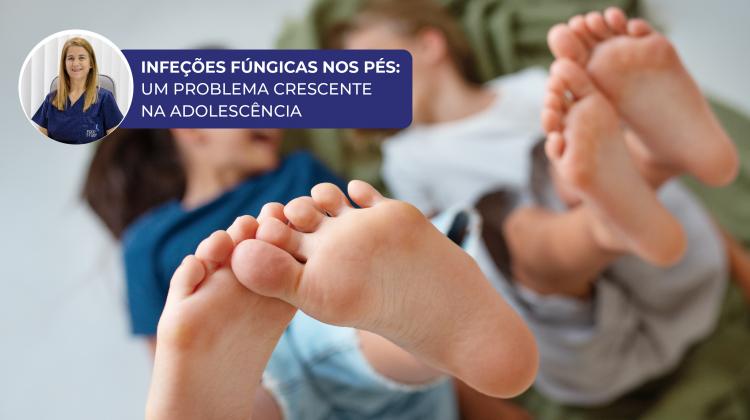 Infeções fúngicas nos Pés: prevalência, diagnóstico e abordagem terapêutica