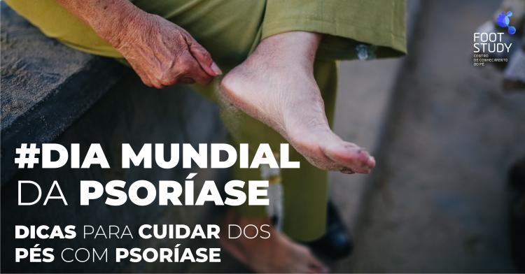 DICAS PARA CUIDAR DOS PÉS COM PSORÍASE
