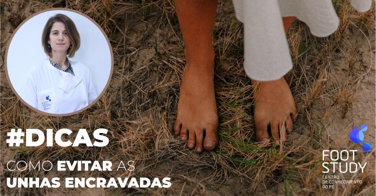 Como tratar as unhas encravadas?