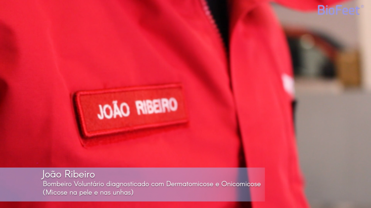 Caso Clínico 06 - Bombeiro diagnosticado com Dermatomicose e Onicomicose